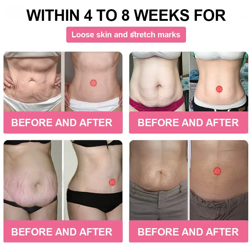 Health Patch - Image 2