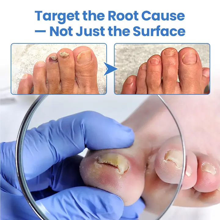 MycoErase Nail Revive Pen - Image 10