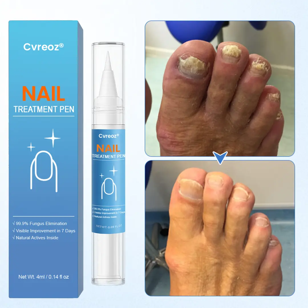 MycoErase Nail Revive Pen - Image 11