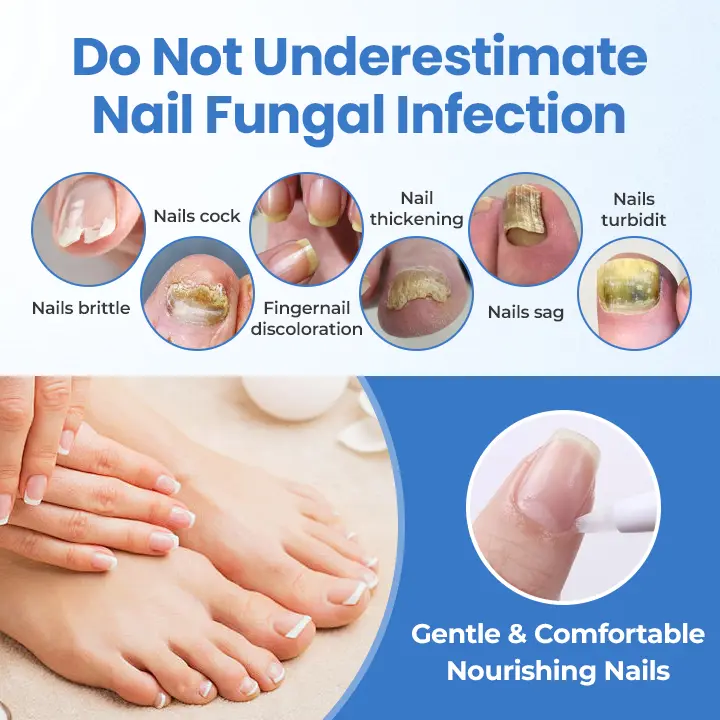 MycoErase Nail Revive Pen - Image 13