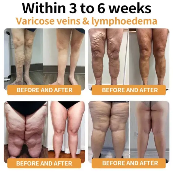 Ultrasonic fat burning and infrared glucose monitoring watch - Image 3