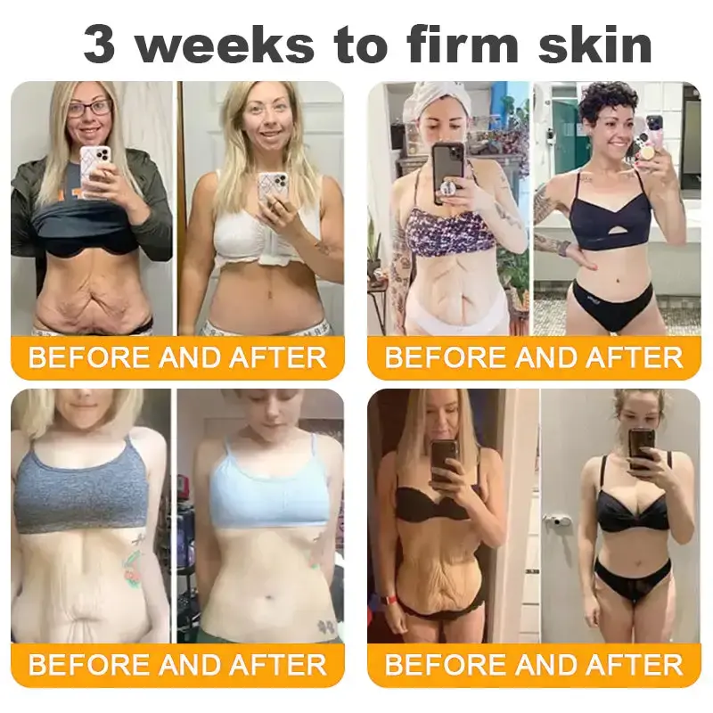 Bee Venom Skin Restoration Cream - Image 9