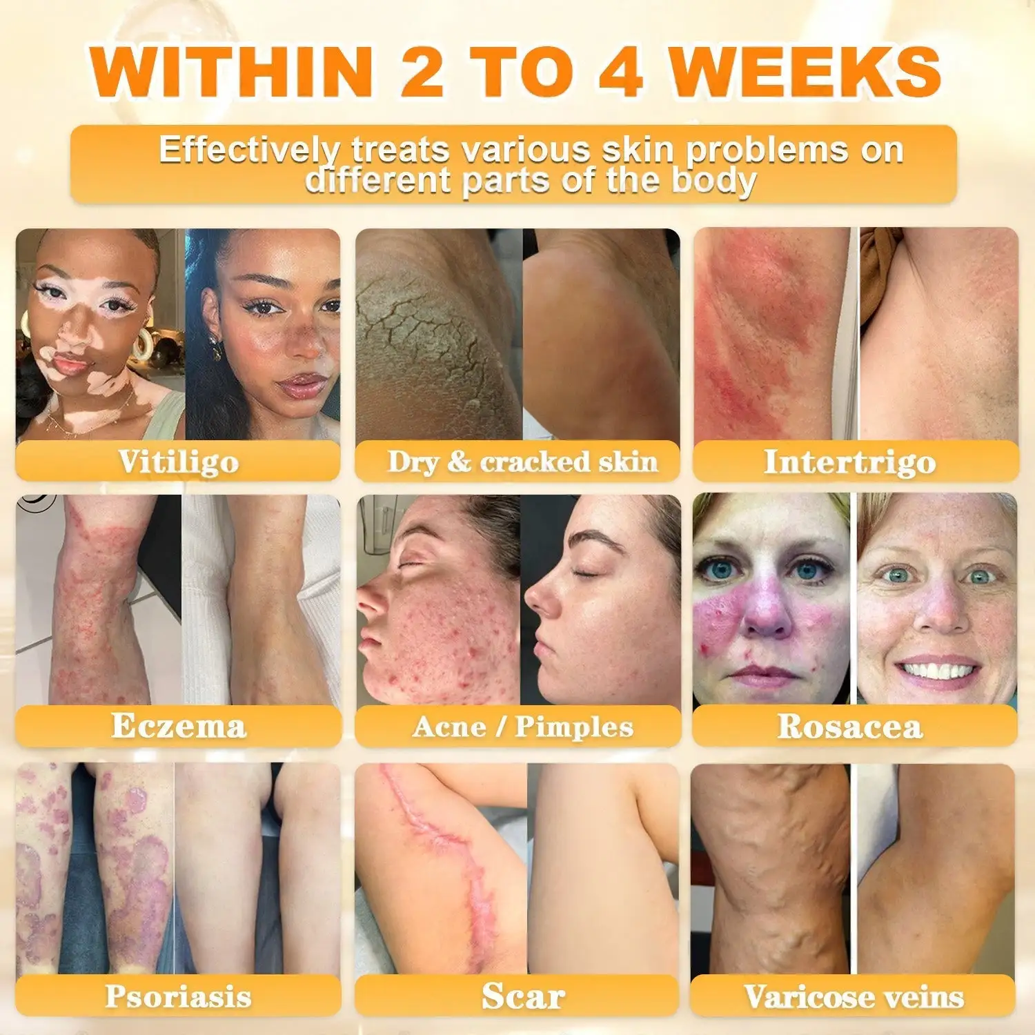 Bee Venom Skin Restoration Cream - Image 5