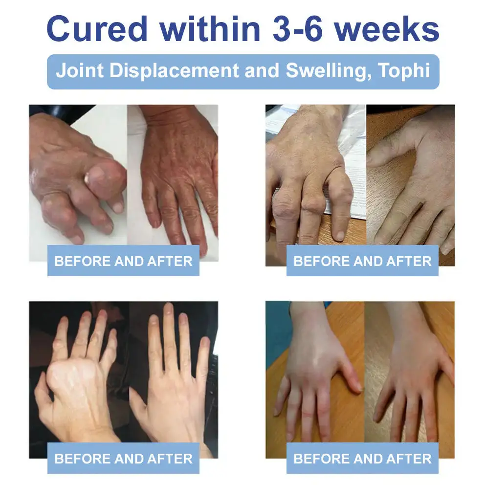 Black Rice Pain Healing Bone Cream - Image 13