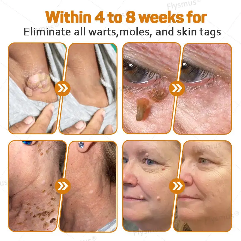 Tag Recede Bee Venom Treatment Cream - Image 2