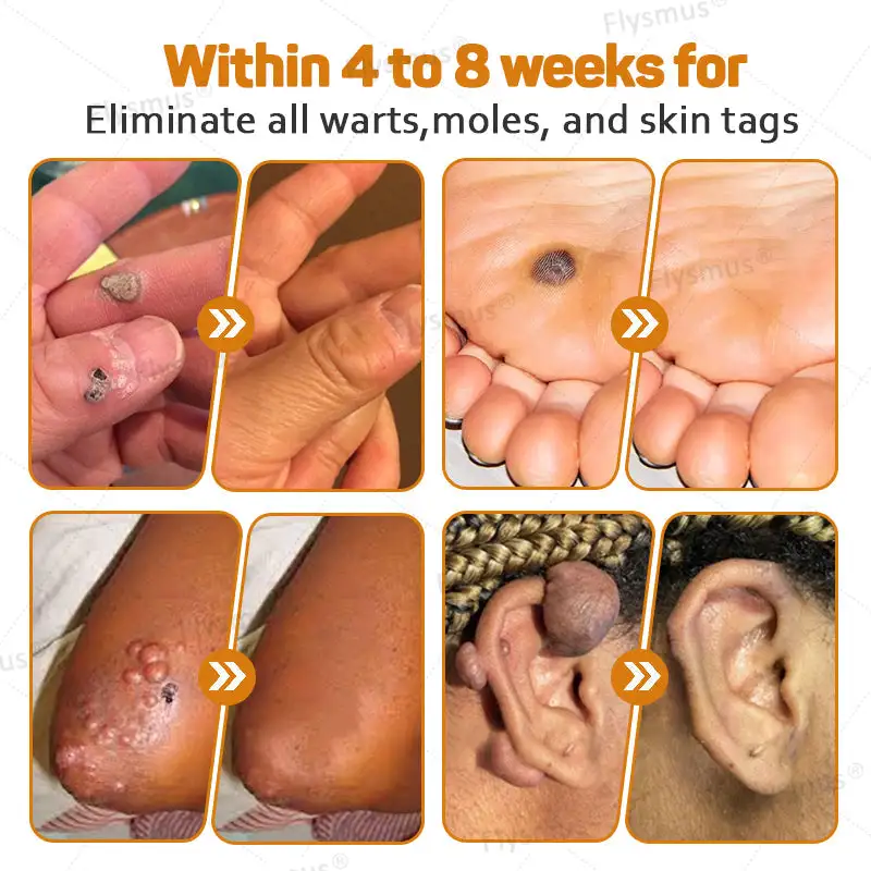 Tag Recede Bee Venom Treatment Cream - Image 3