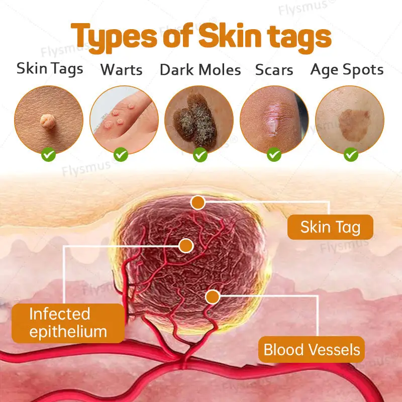 Tag Recede Bee Venom Treatment Cream - Image 4