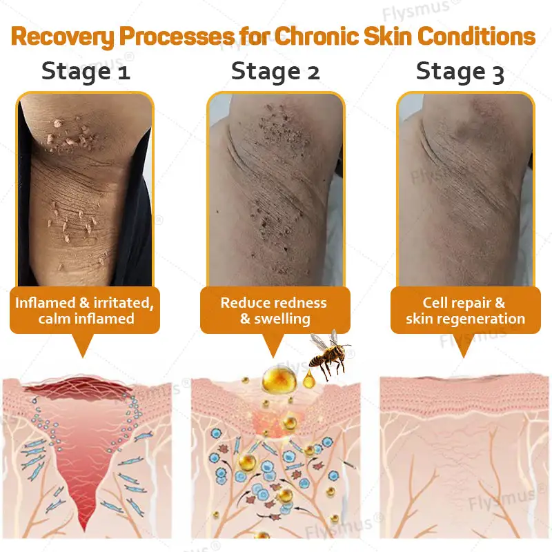 Tag Recede Bee Venom Treatment Cream - Image 6