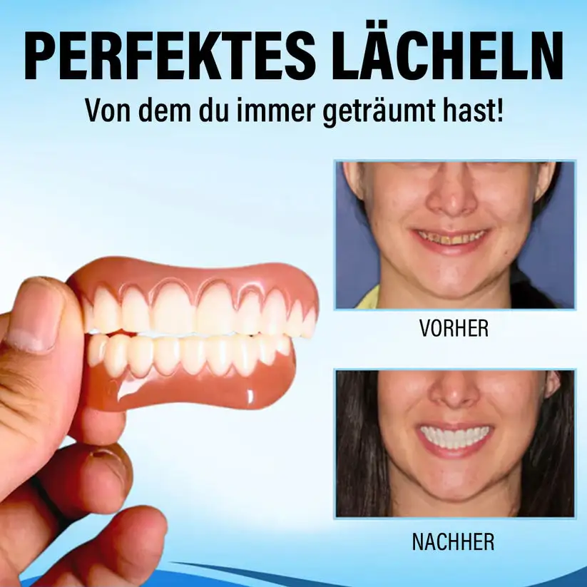 Implantes dentales - Image 4