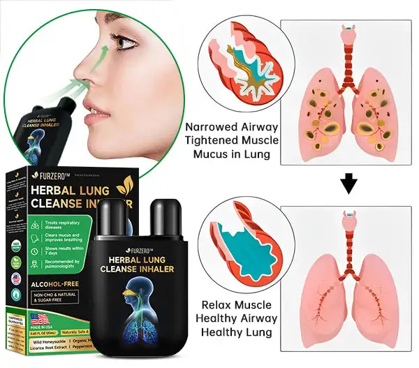 Lung Mucus Cleansing Inhaler - Image 5