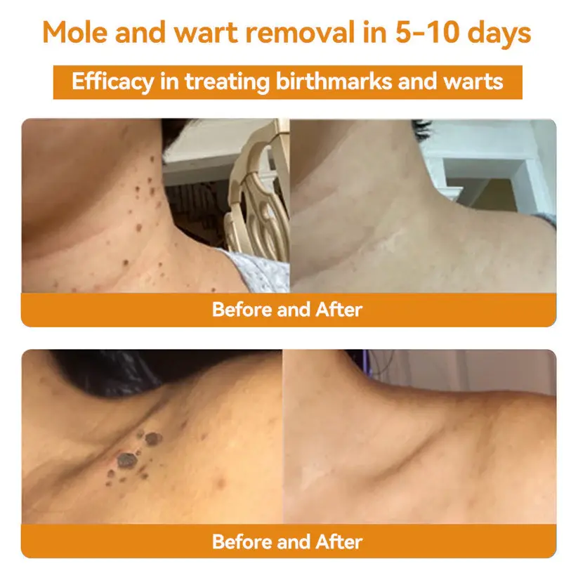 Bee Venom Skin Treatment Cream - Image 5