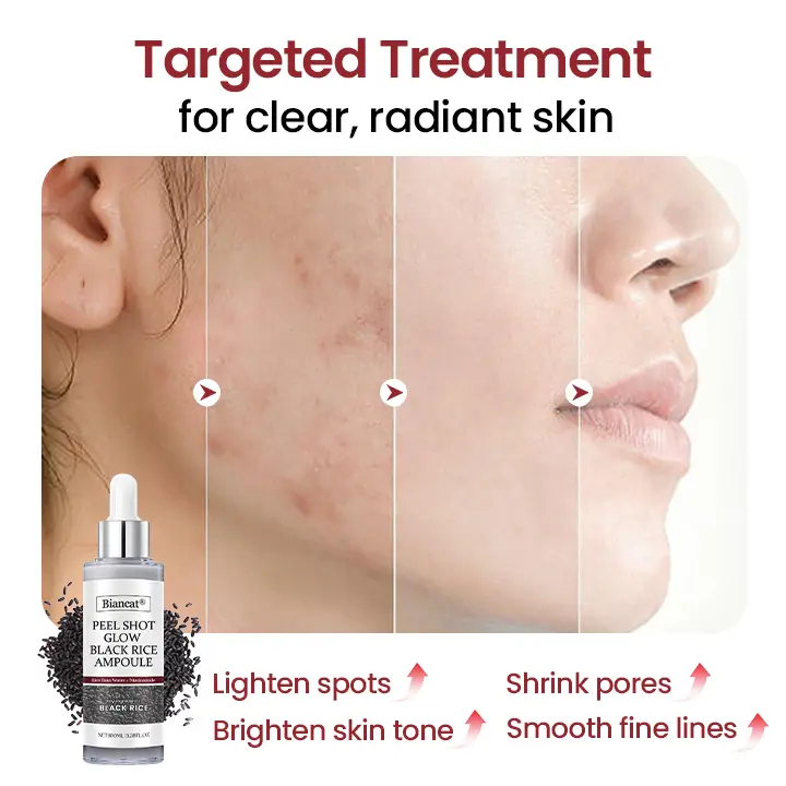 Peel Shot Glow Black Rice Ampoule - Image 3