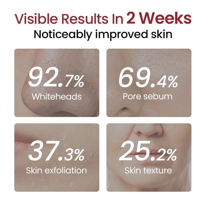 Peel Shot Glow Black Rice Ampoule - Image 4