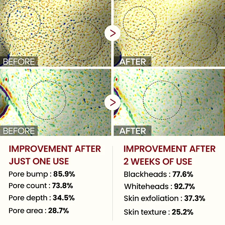 Peel Shot Glow Black Rice Ampoule - Image 6