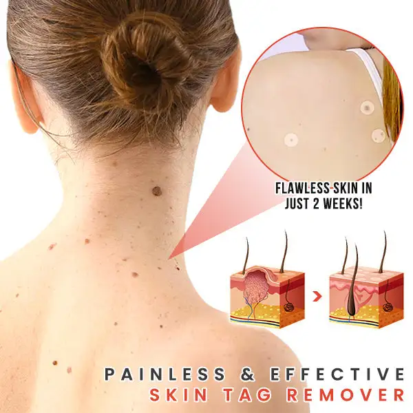 MicroDarts TAG'Gone Patch - Image 3