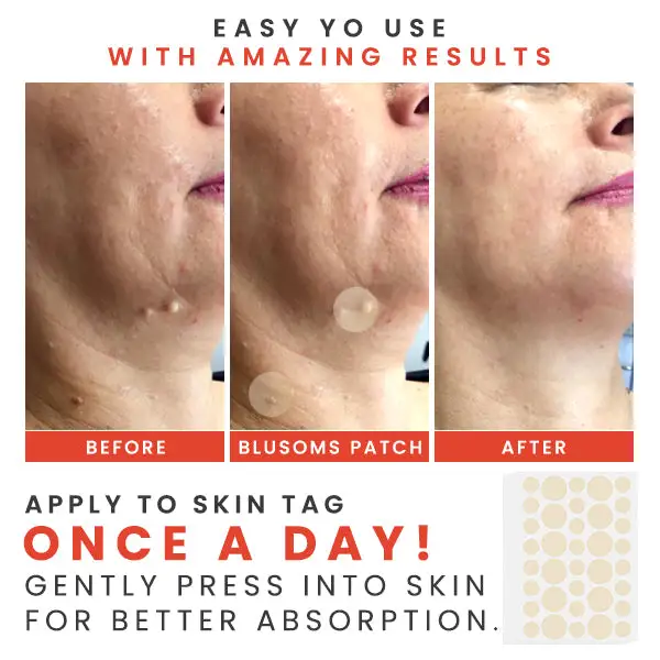 MicroDarts TAG'Gone Patch - Image 5