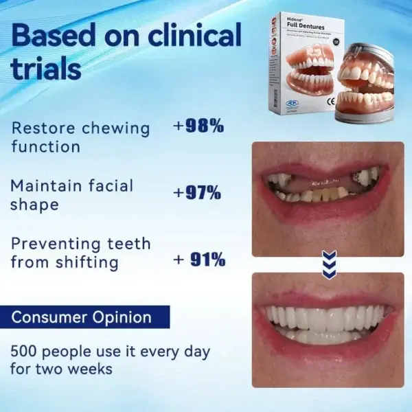 Full Denture Set Advanced Self-Adjusting Dental Materials - Image 3