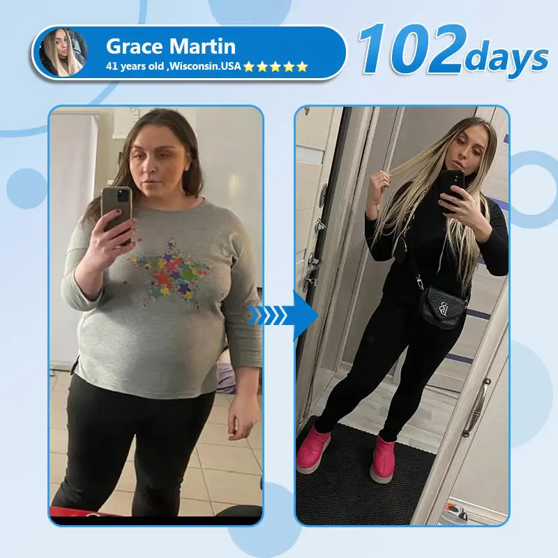 Nano Microneedle Patch - Image 8