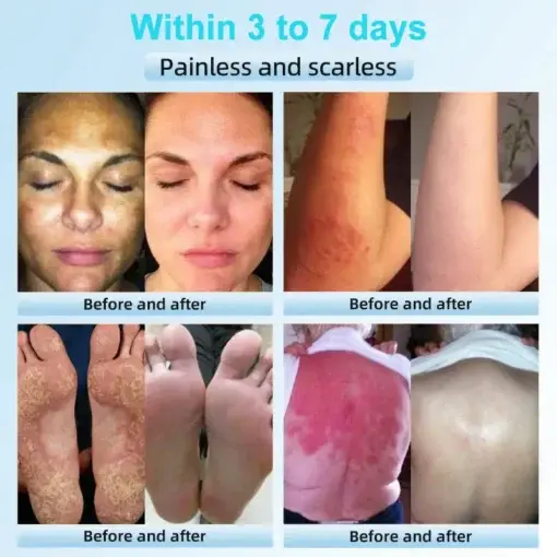 Exfoliating Cream for Dark Spots & Firmer Skin - Image 4