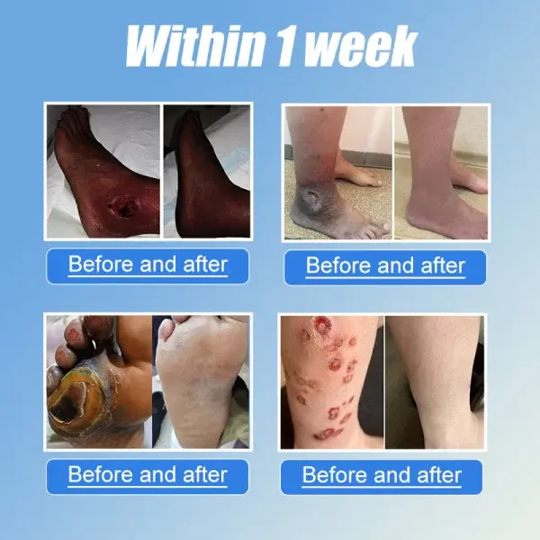 VitaGluco Diabetes Treatment Cream - Image 3