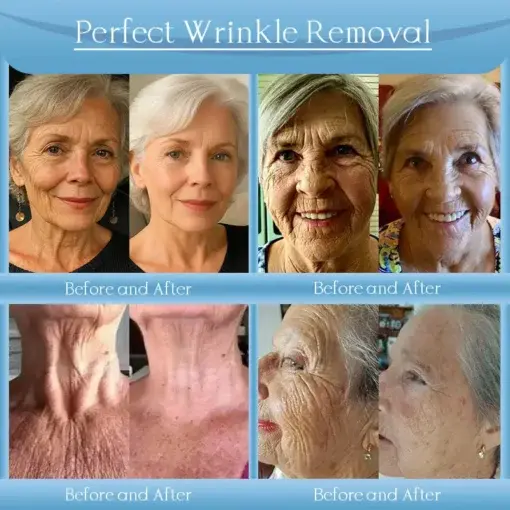 Anti-Wrinkle Skin Cream - Image 2