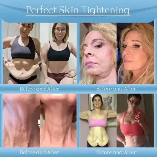 Anti-Wrinkle Skin Cream - Image 3