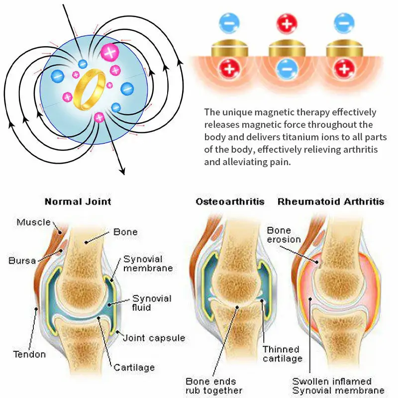 DIYSTAR Lymphatic magnetic therapy cats eye ring - Image 4