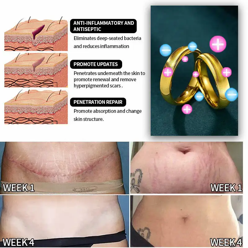 DIYSTAR Lymphatic magnetic therapy cats eye ring - Image 6