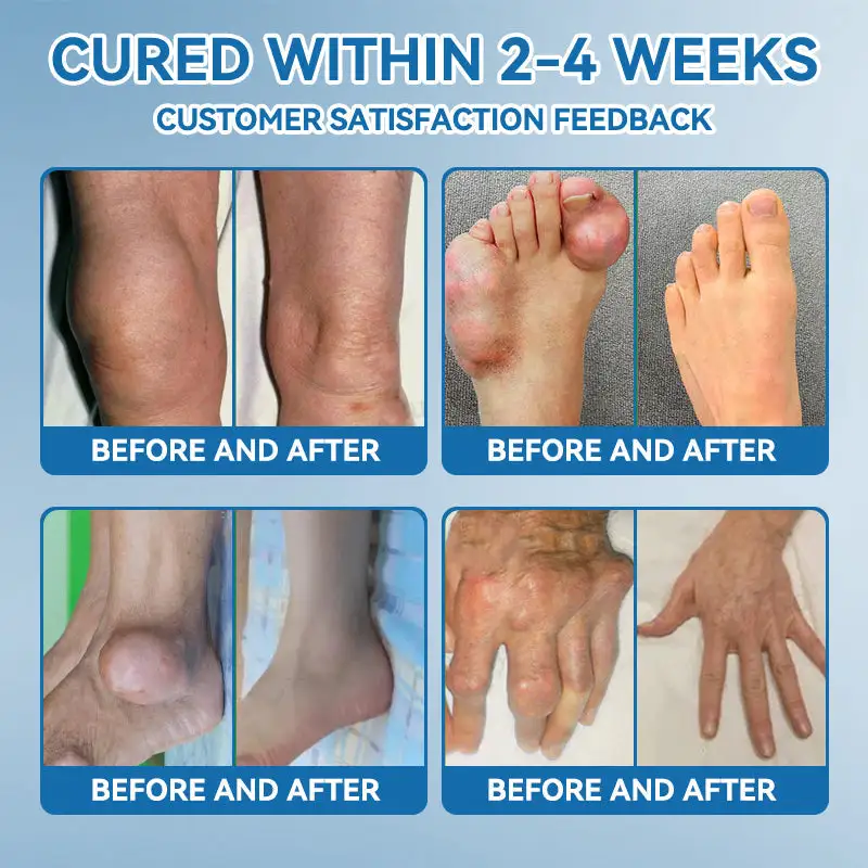 ๐๐๐-๐๐๐ ๐๐จ๐ข๐ง๐ญ ๐๐๐๐ฅ๐ข๐ง๐ ๐๐ซ๐๐๐ฆ ๐๐ซ๐๐๐ญ๐ฌ ๐๐ซ๐ญ๐ก๐ซ๐ข๐ญ๐ข๐ฌ - Image 2