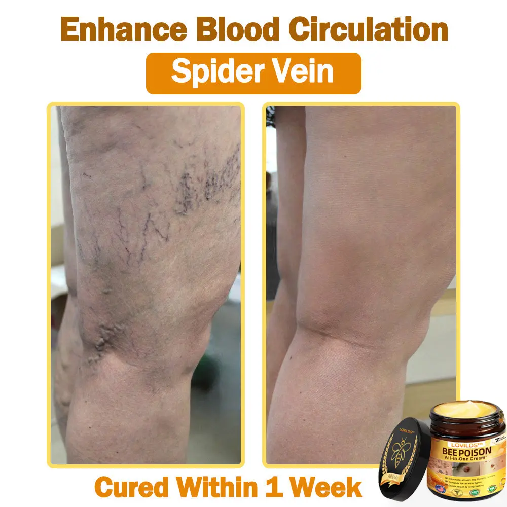 ๐๐๐ ๐๐๐ง๐จ๐ฆ ๐๐ฅ๐ฅ-๐ข๐ง-๐๐ง๐ ๐๐ซ๐๐๐ฆ - Image 10