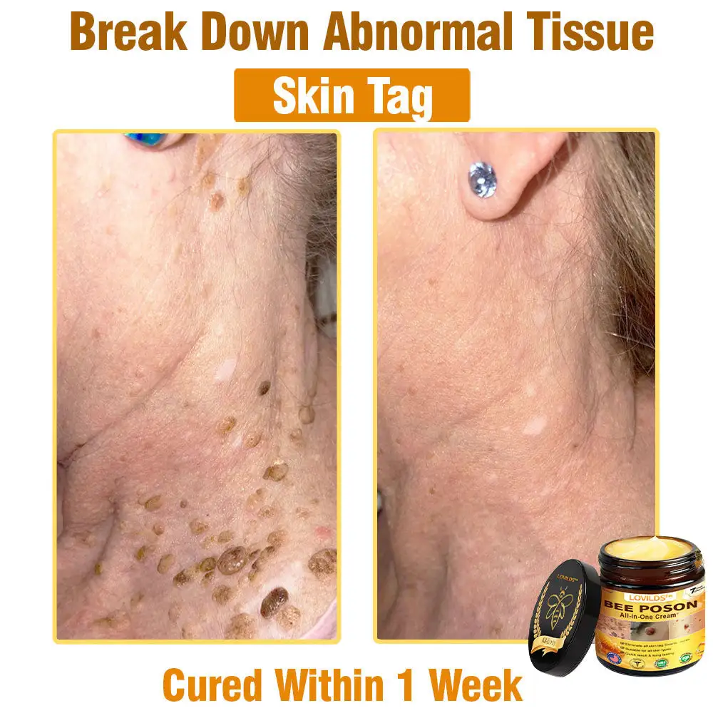 BEE POSON All-in-One Cream - Image 10