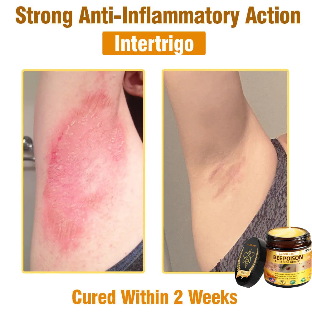 Bee Poison All-in-One Cream US Dermatologist Approved - Image 12