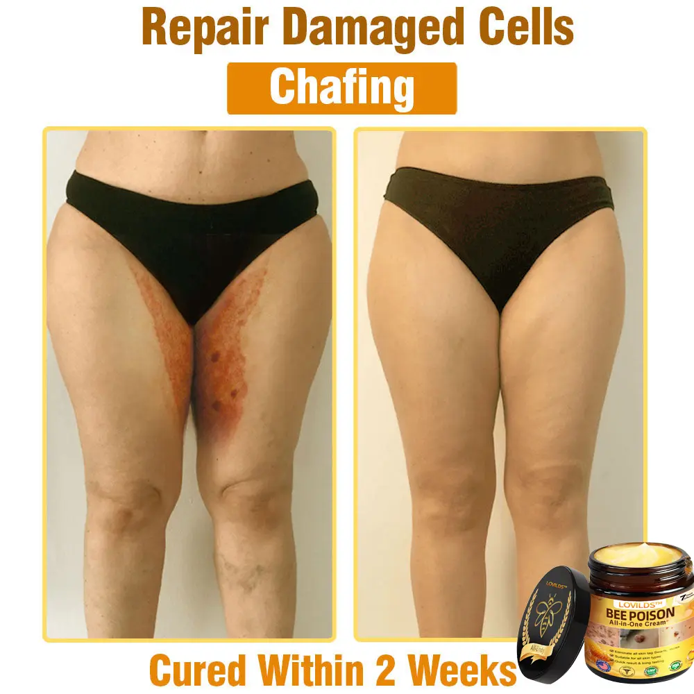 Bee Poison All-in-One Cream US Dermatologist Approved - Image 3