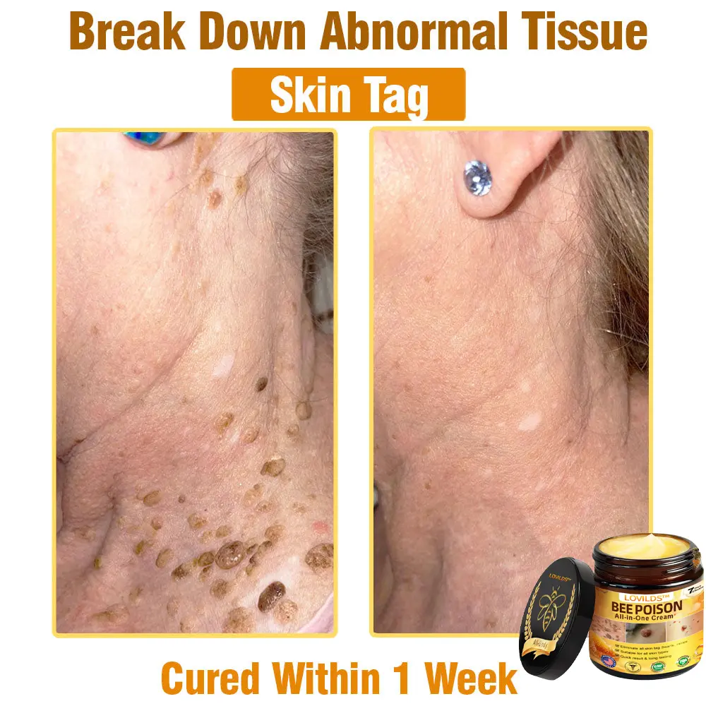 Bee Poison All-in-One Cream US Dermatologist Approved - Image 6