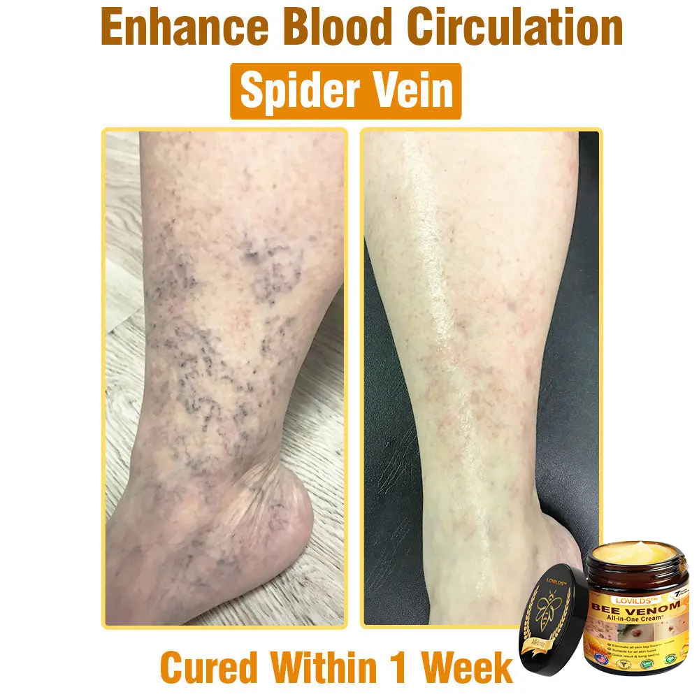 Bee Venom Cream - Image 12