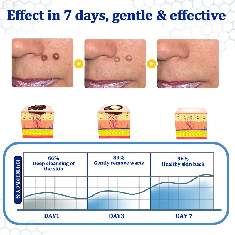 BeeDerm RX Cream - Image 4