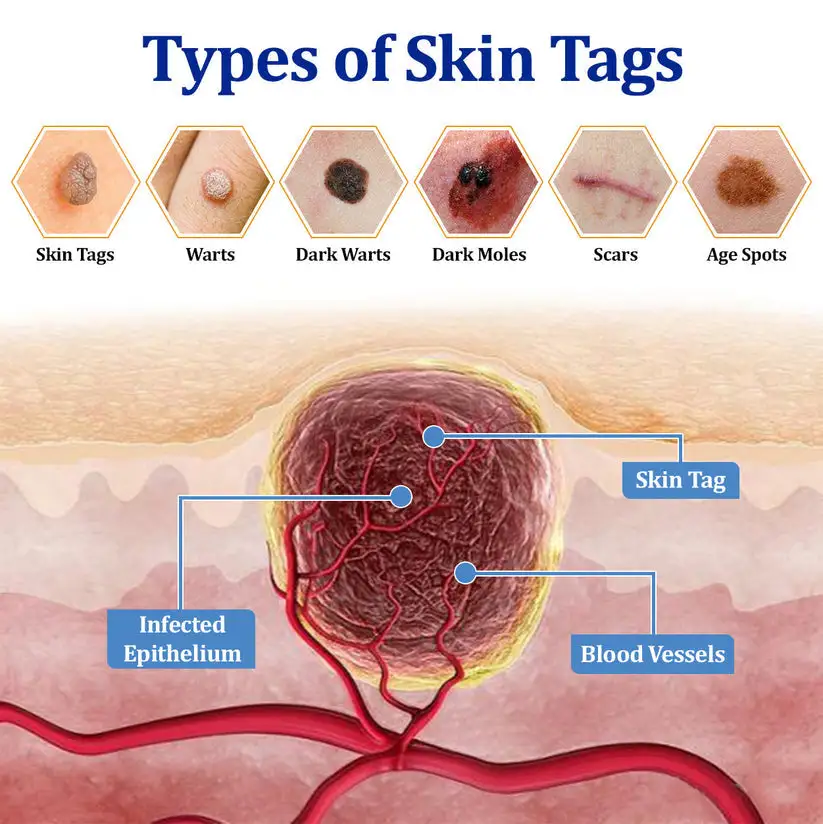 BeeDerm RX Cream - Image 5