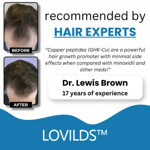 Clinically Backed Hair Regrowth Formula Trusted by Experts - Image 6