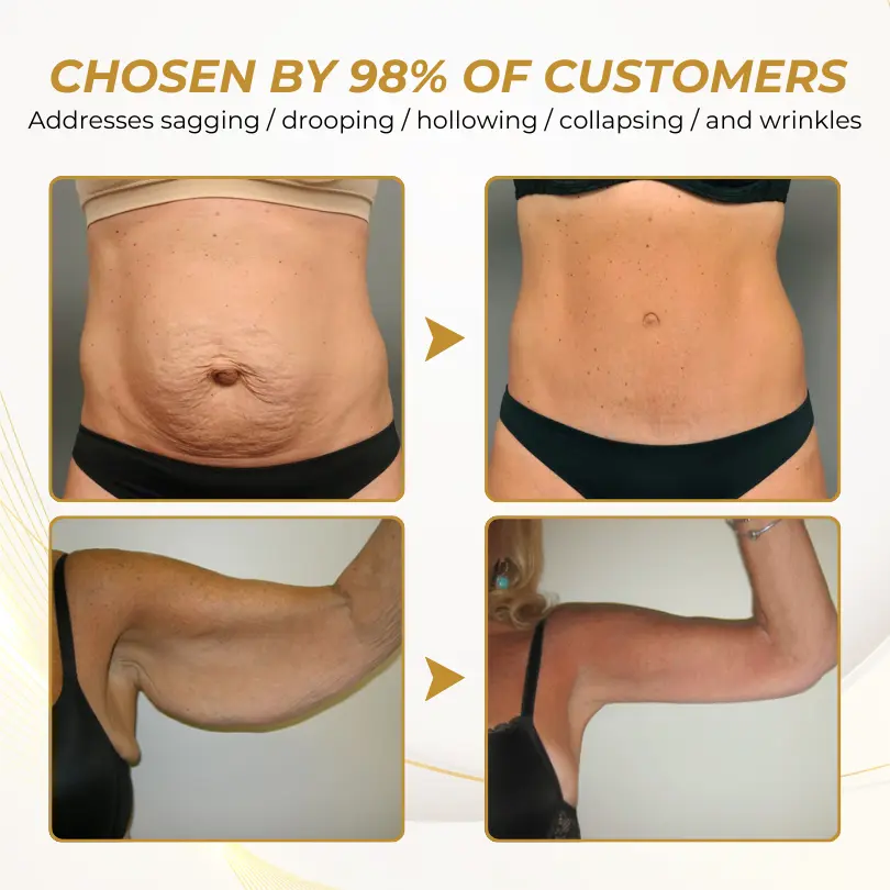 FirmFlora Skin Lifting Cream - Image 6