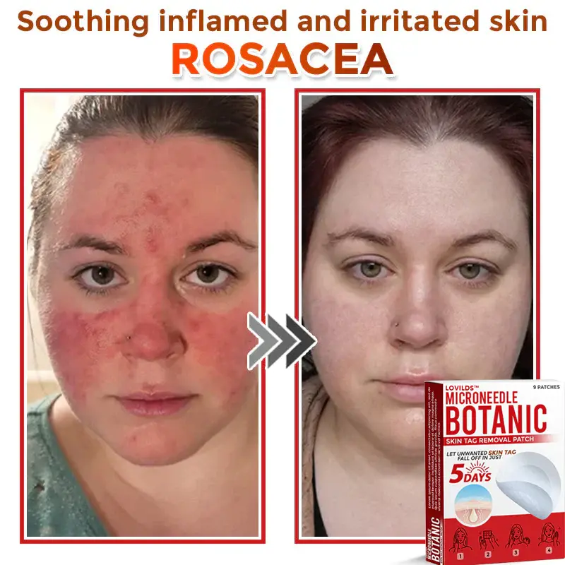 Removal Patch - Image 7