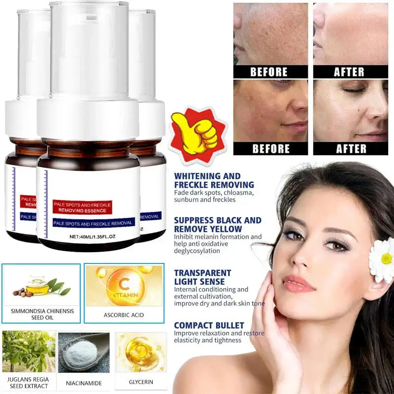 WHITENING ANDFRECKLE REMOVING ESSENCE
