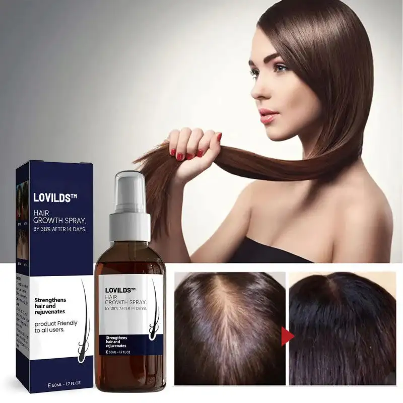 LOVILDS Natural Hair Regrowth Spray - Image 3