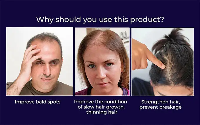 LOVILDS Natural Hair Regrowth Spray - Image 7