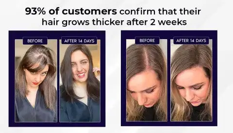 LOVILDS Natural Hair Regrowth Spray - Image 9