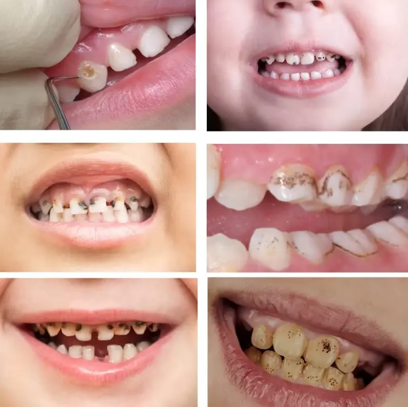 Advanced Dental Care Toothpaste - Image 6