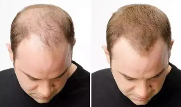 Hair Restoration Spray - Image 6