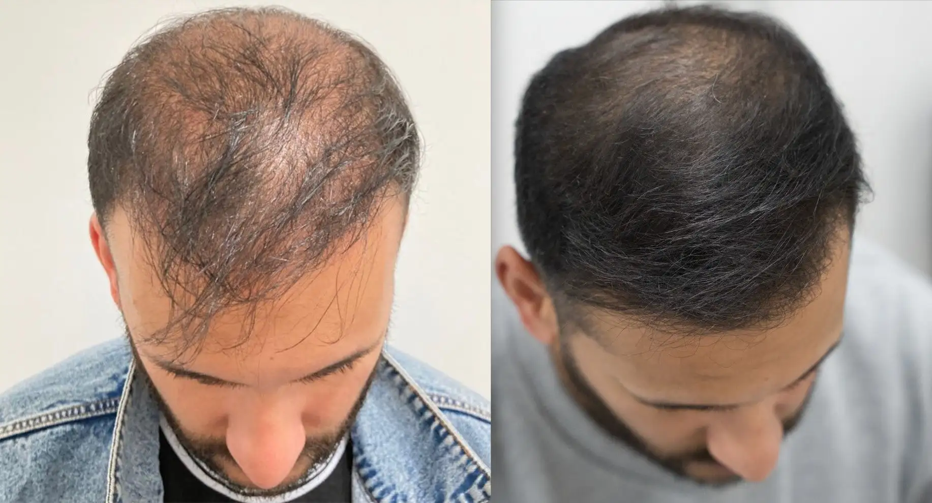 Hair Restoration Spray - Image 7