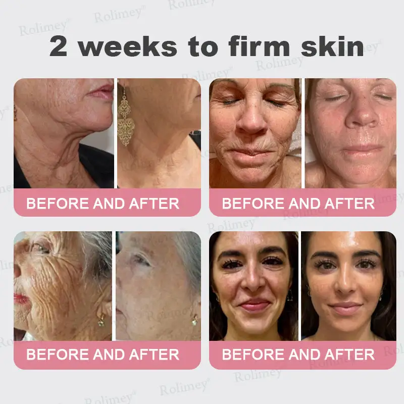 Bio-Botox PDRN Collagen Wrinkle Stick - Image 3