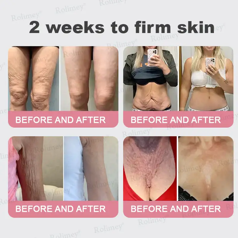 Bio-Botox PDRN Collagen Wrinkle Stick - Image 4