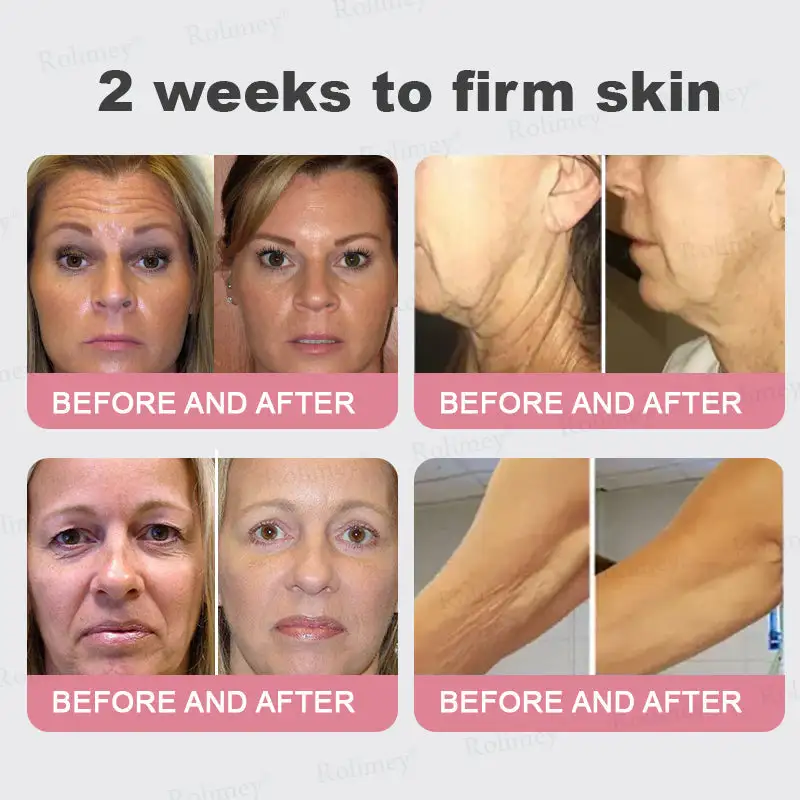 Bio-Botox PDRN Collagen Wrinkle Stick - Image 5